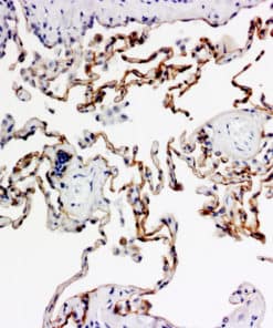ihcDirect Podoplanin IHC stain, frozen lung tissue, DAB chromogen