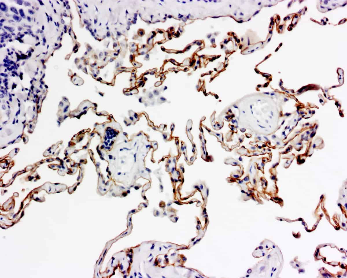 ihcDirect Podoplanin IHC stain, frozen lung tissue, DAB chromogen - Novodiax ihcDirect Podoplanin IHC stain, frozen lung tissue, DAB chromogen