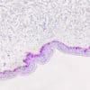 Novodiax magenta chromogen for IHC on MART-1
