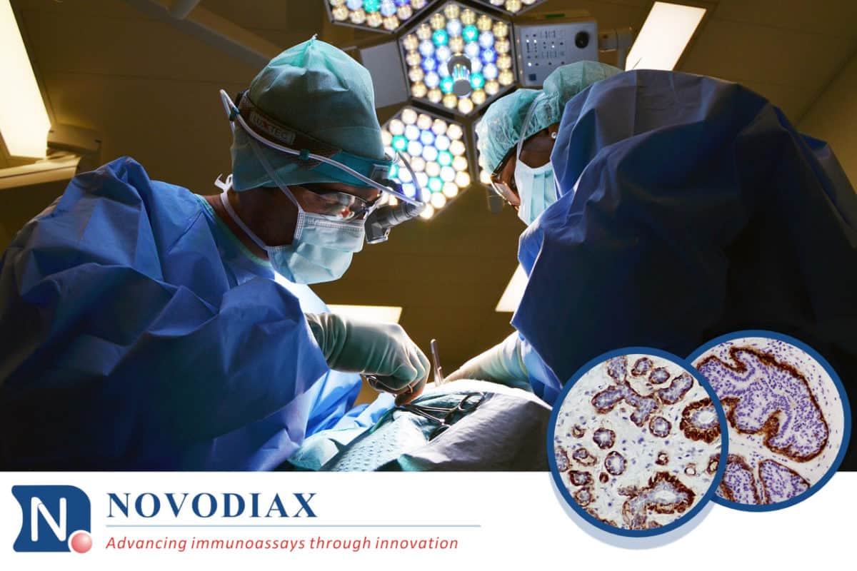 surgeons performing intra-operative IHC testing on breast lesions