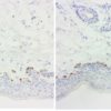 ihcDirect Mart-1(L), with ihc Enhancer(R)
