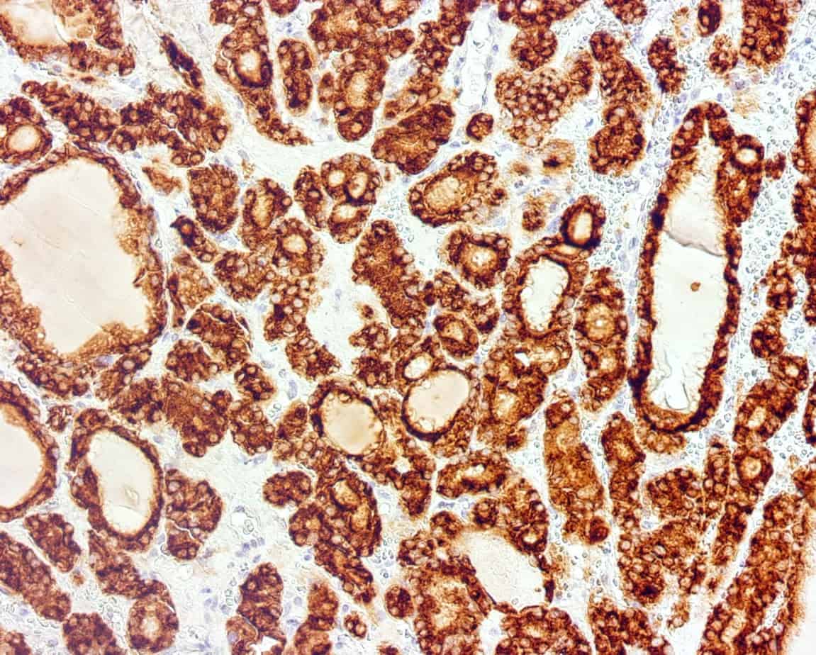 QSX TPO (Clone C129) on FFPE normal thyroid