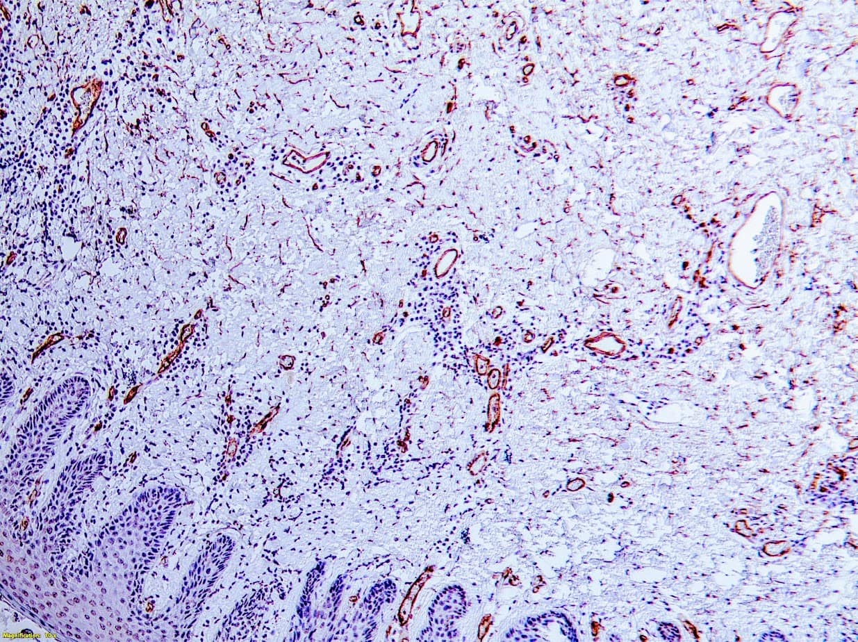 QSX CD34 (Clone QBend10) on FFPE axillary skin