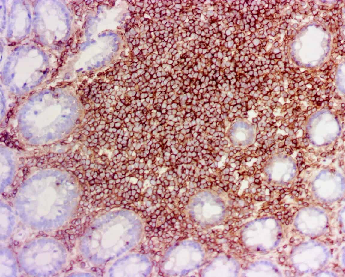 QSX CD45 (Clone C95) on frozen colon lymph node with EFISHA pretreatment