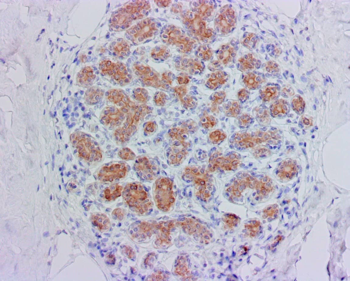 QSX CK5 (Clone R226) on FFPE Normal Breast