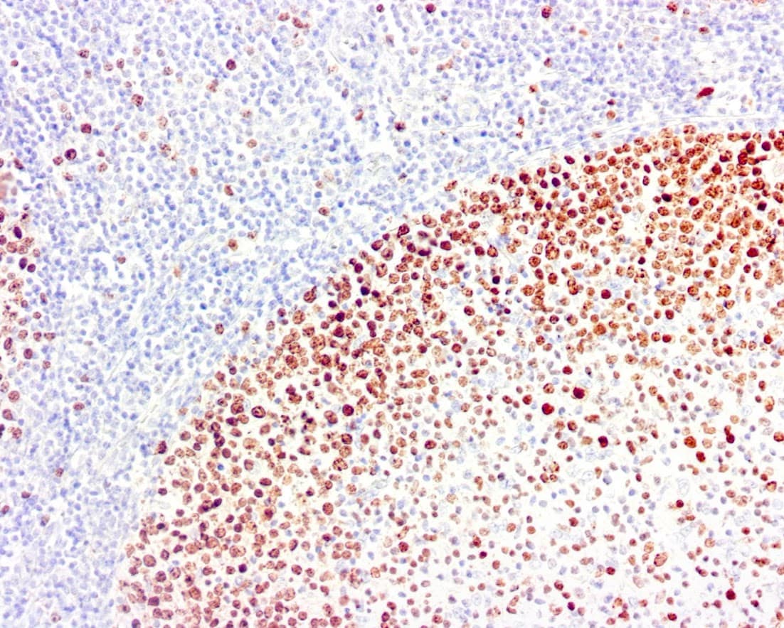 QSX Ki67 (Clone R360) on frozen tonsil with EFISHA treatment