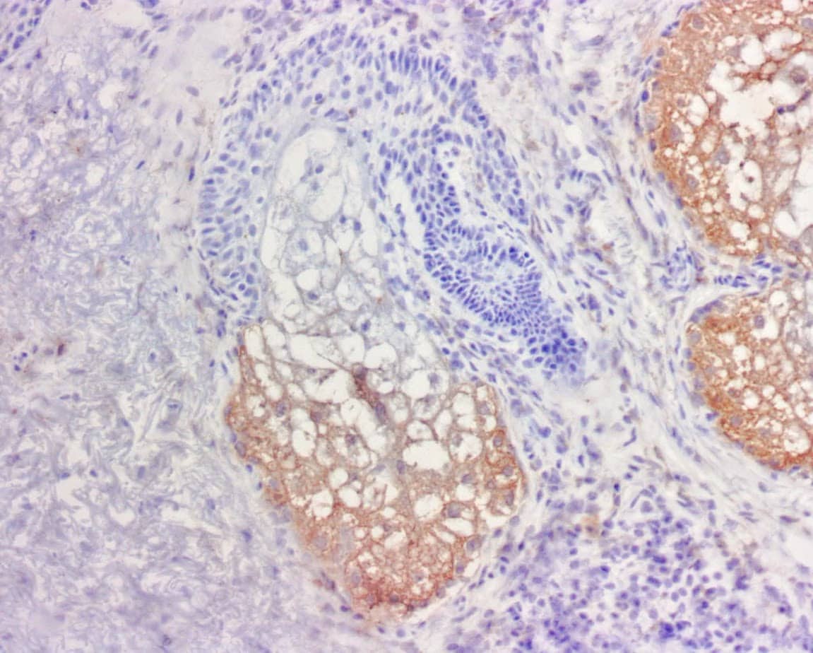 QSX PRAME (Clone R1009) on sebaceous glands of frozen skin