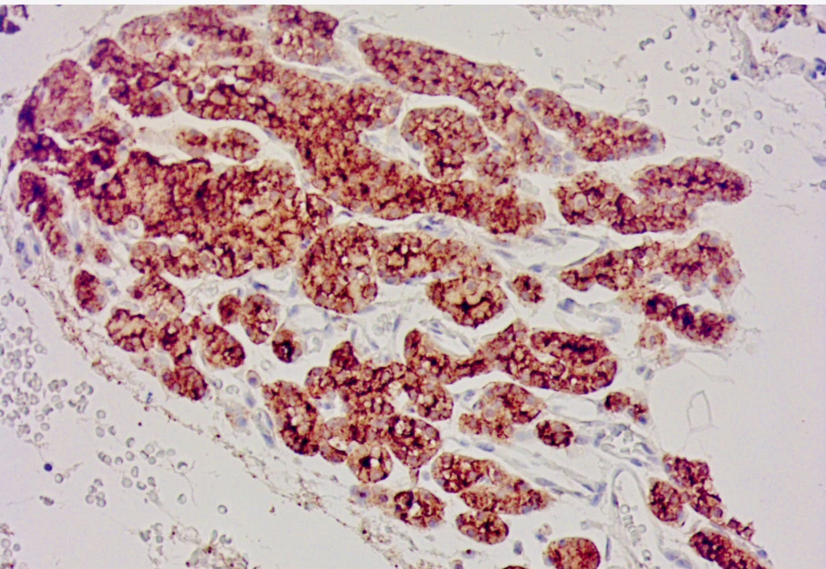 QSX PTH (Clone C123) on FFPE parathyroid gland