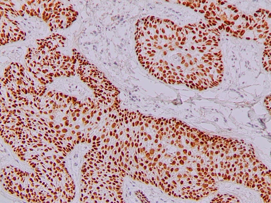 QSX p40 (Clone R392) on frozen skin with EFISHA treatment
