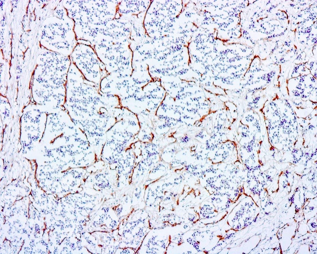 ihc CD34 (Clone QBend10) on frozen liver