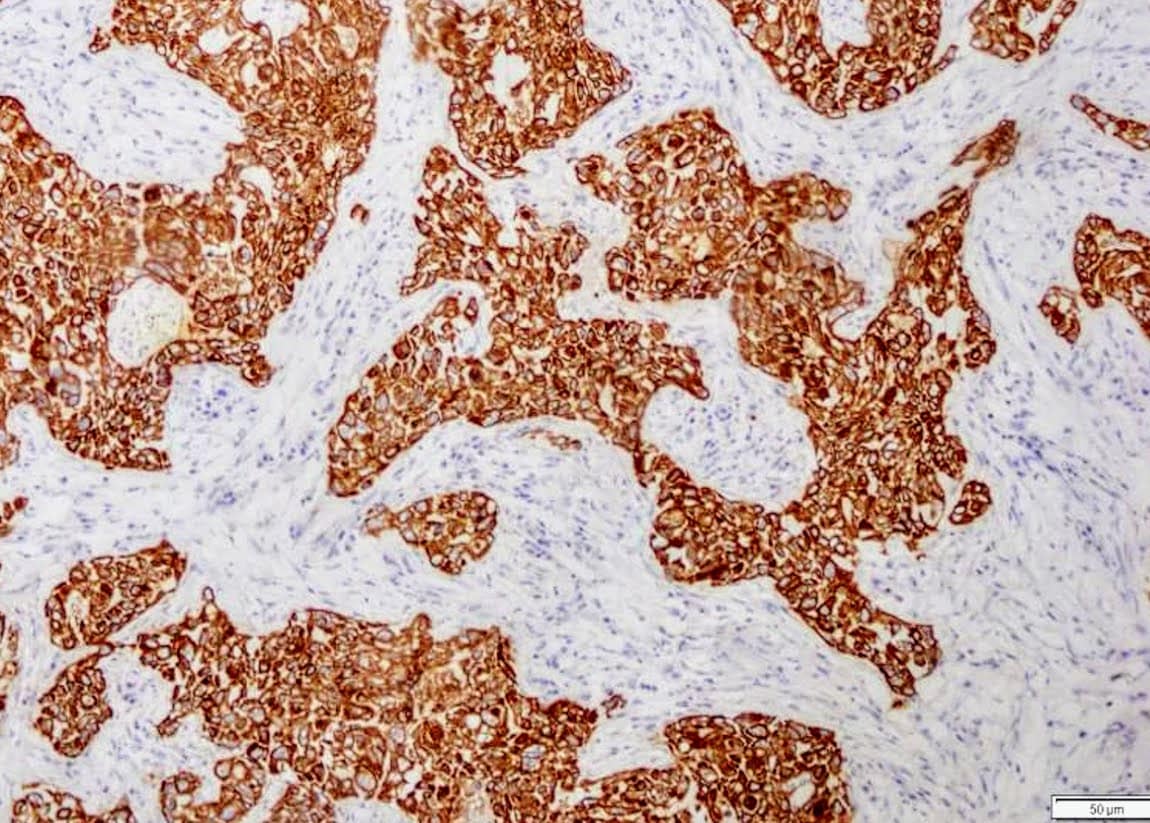 ihcDirect AE1AE3 on frozen Breast