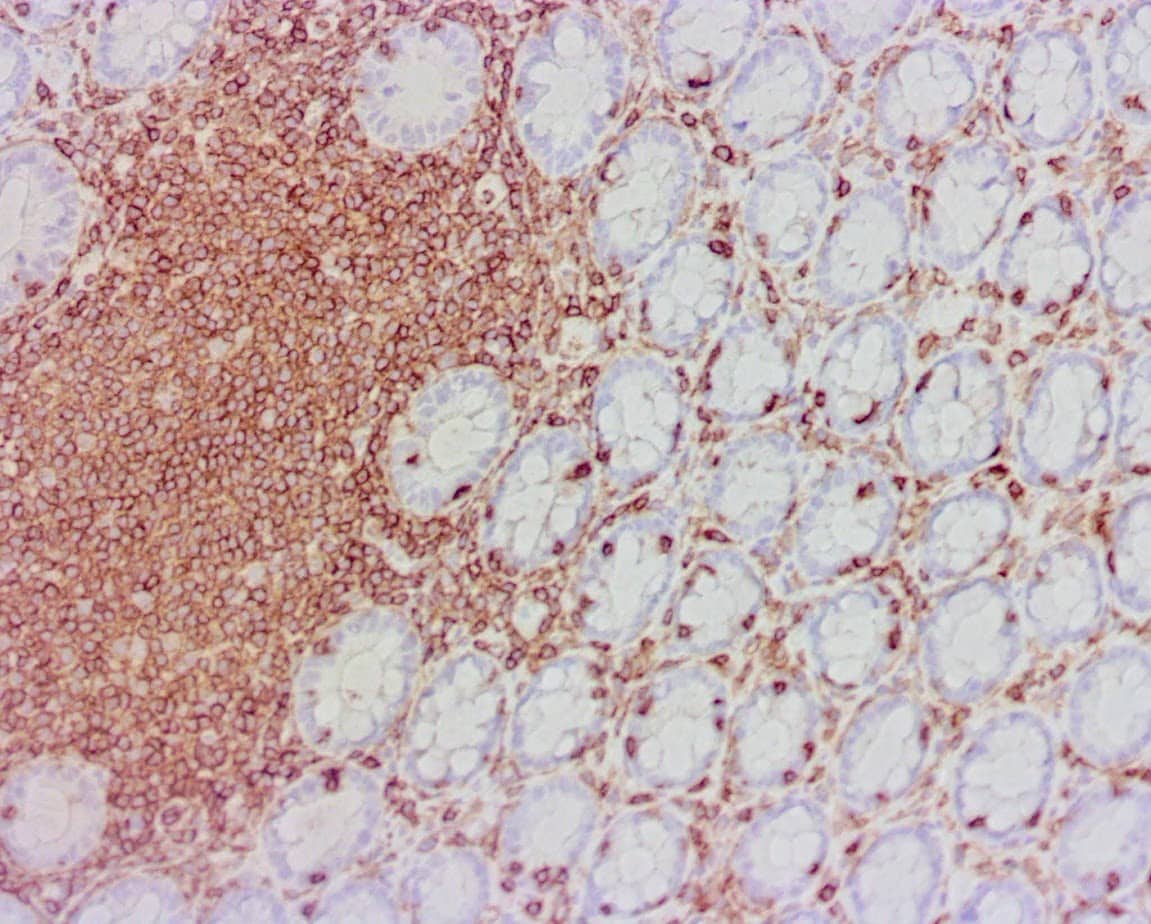ihcDirect CD45 (Clone C95) on frozen colon lymph node with EFISHA pretreatment