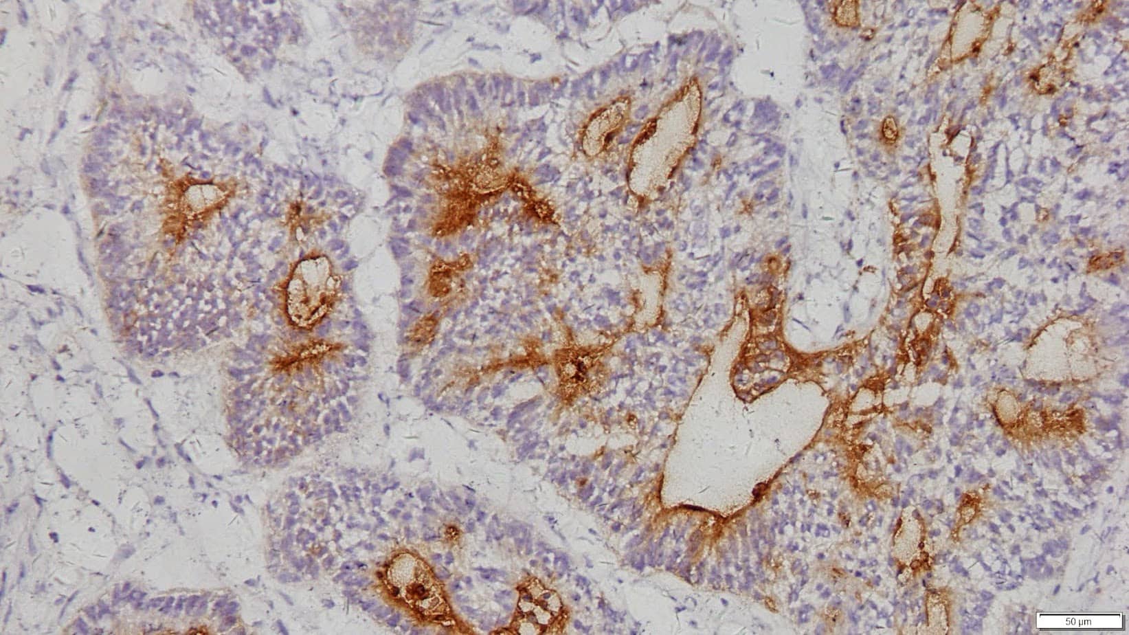 ihcDirect CEA (Clone C135) on frozen ovary