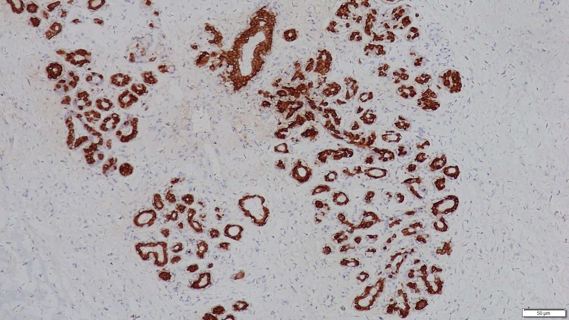 ihcDirect CK19 (Clone R1002) on frozen Breast