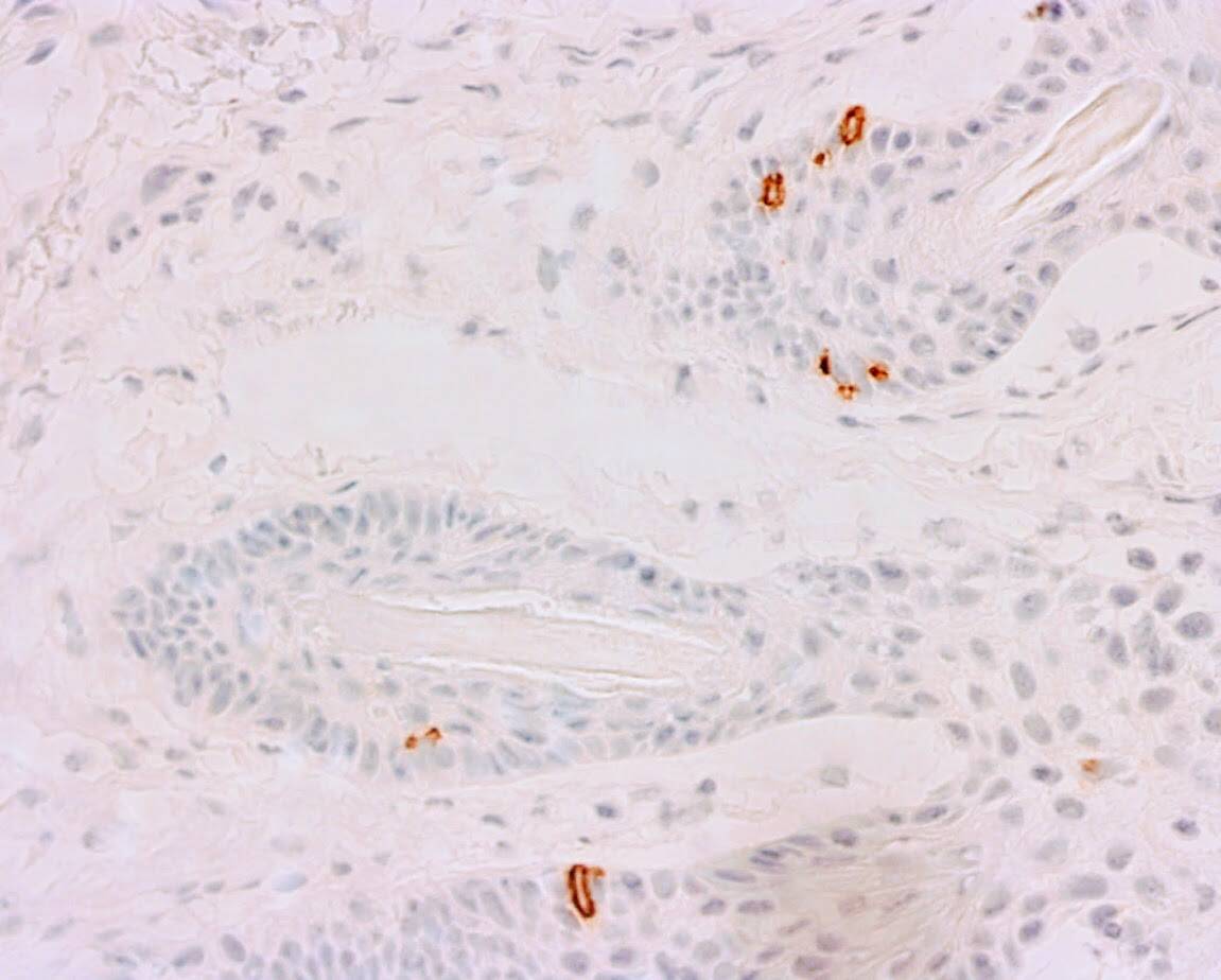 ihcDirect CK20 (Clone R1001) frozen skin Merkel Cells