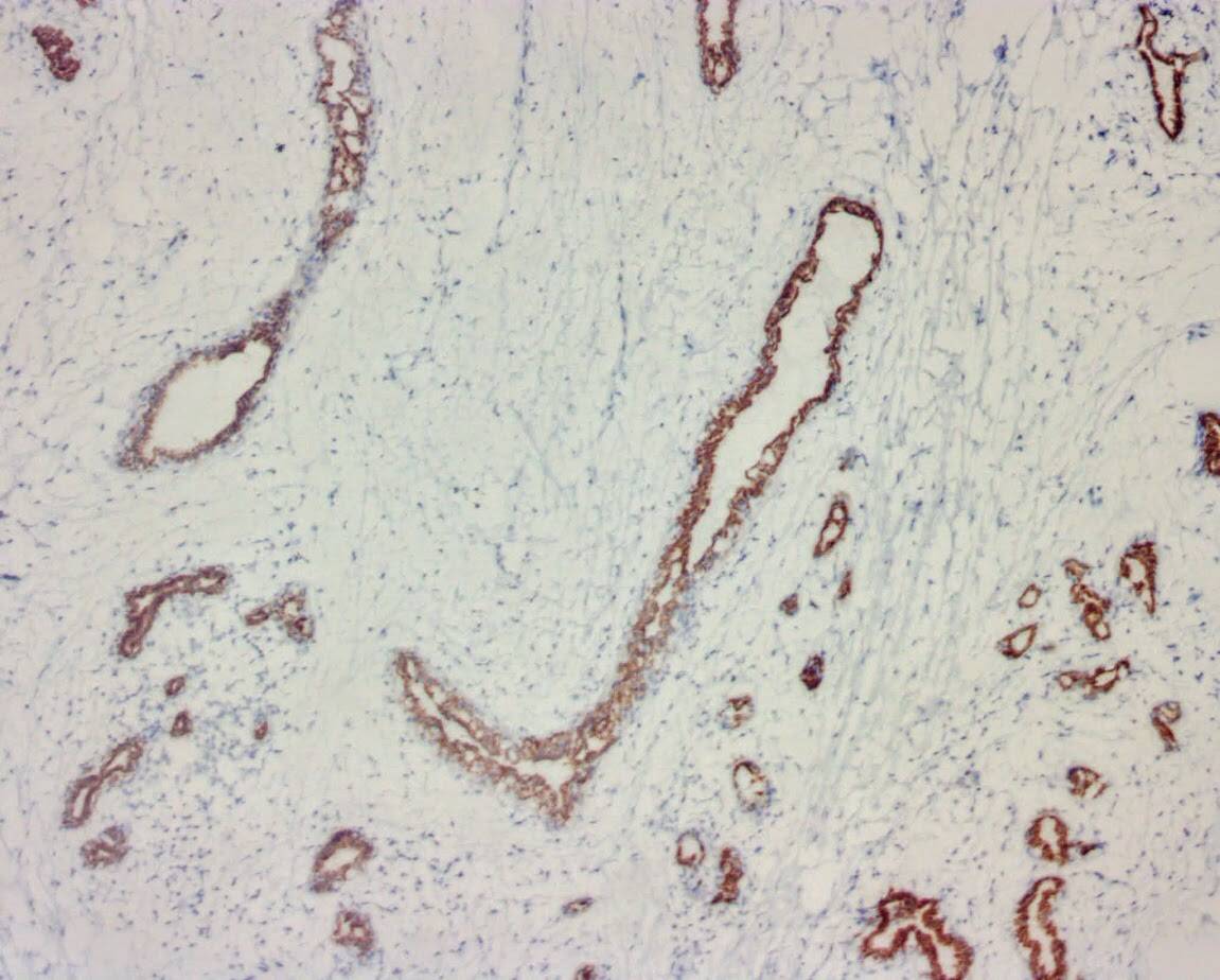 ihcDirect CK7 (Clone R284) on frozen breast