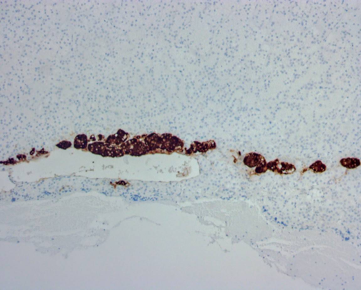 ihcDirect Chromogranin A (Clone R1004) on FFPE Adrenal Gland
