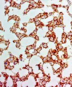 E-Cadherin Ab-Enh/Ab