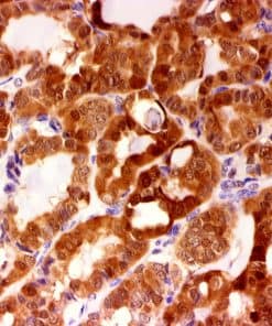 Galectin-3 Ab-Enh/Ab