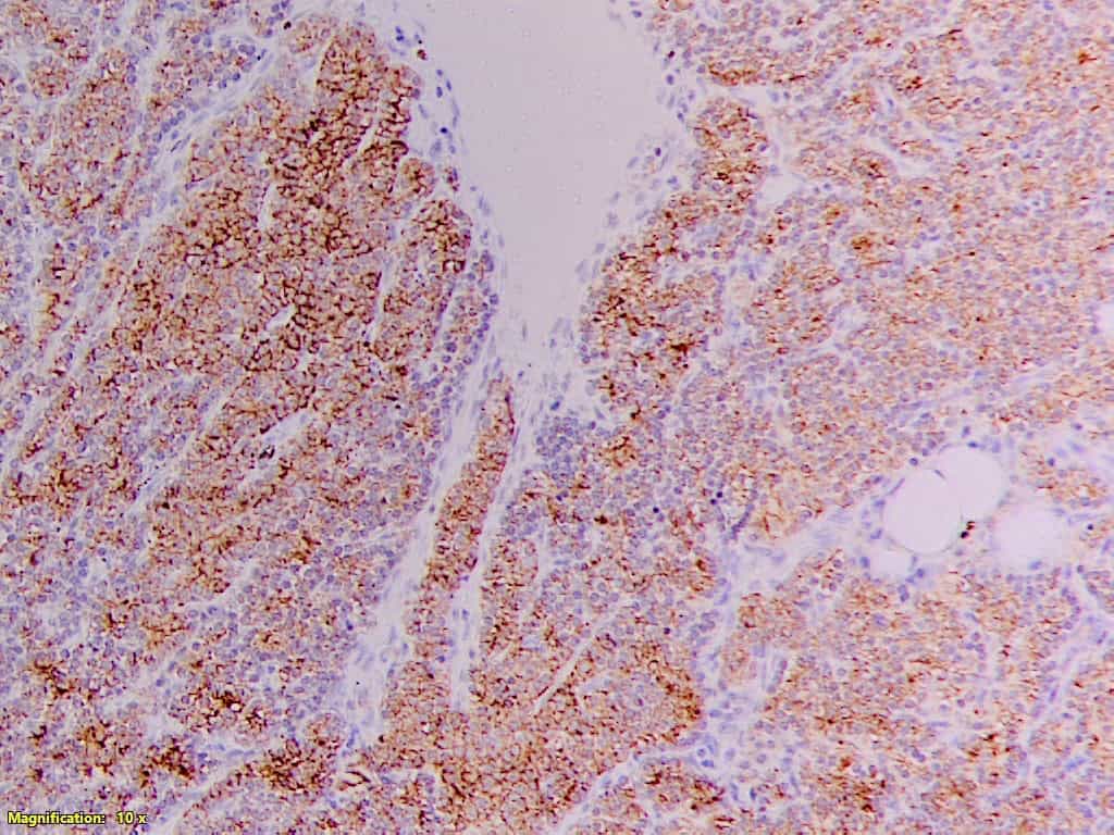 ihcDirect PTH (Clone C123) on FFPE parathyroid gland