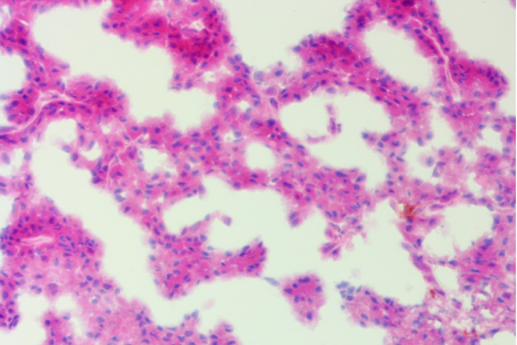 ihcDirect PTH (Clone C123) on frozen parathyroid gland with magenta chromogen