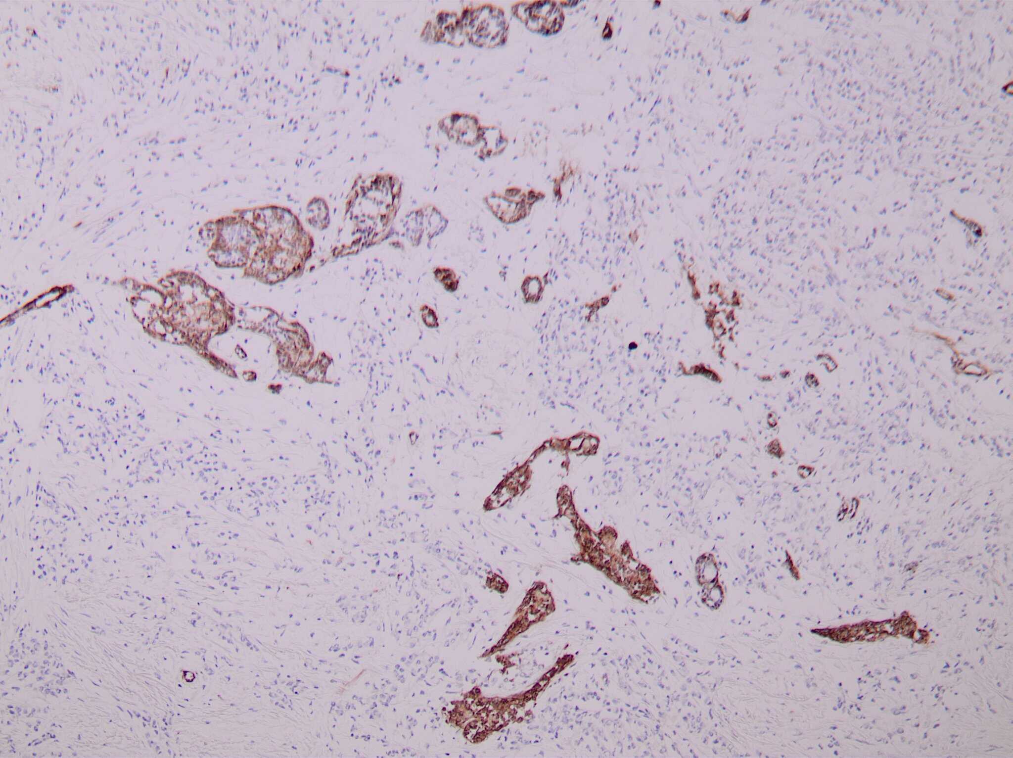ihcDirect SMMHC (Clone SMMS-1) on frozen breast