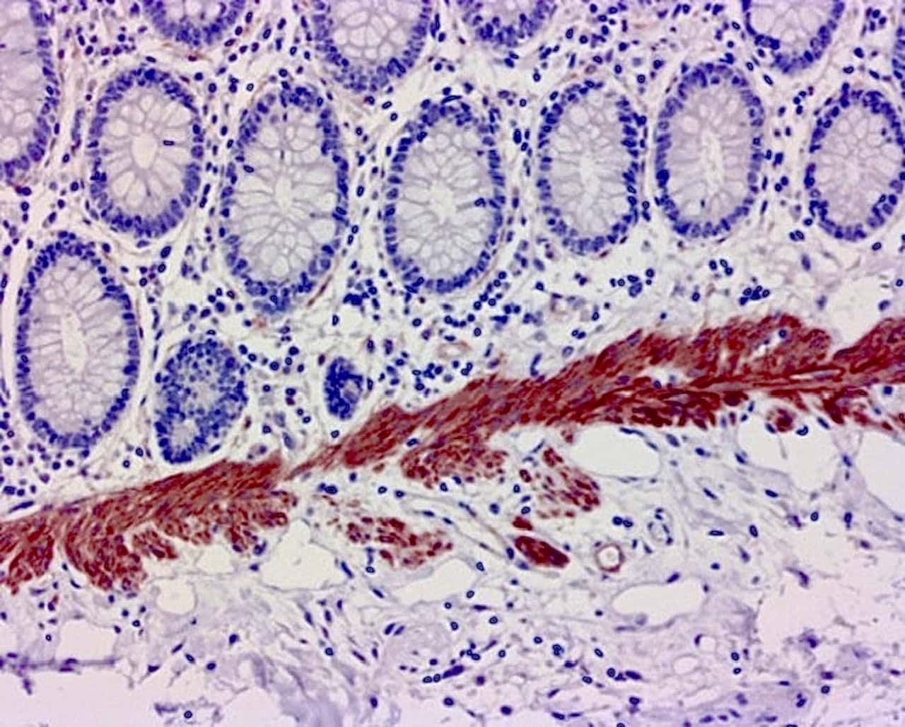 ihcDirect SMMHC (Clone SMMS-1) on frozen colon