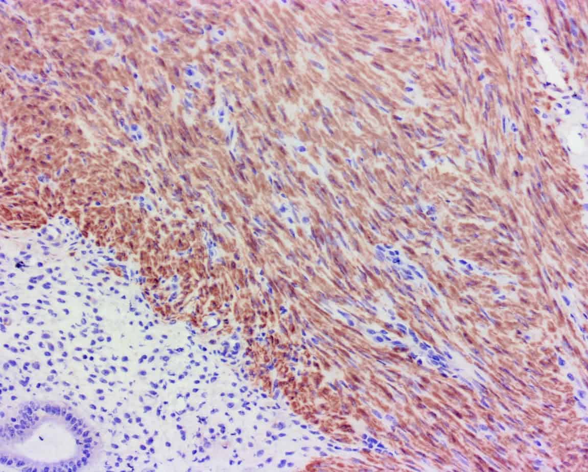 ihcDirect SMMHC (Clone SMMS-1) on frozen uterus ed