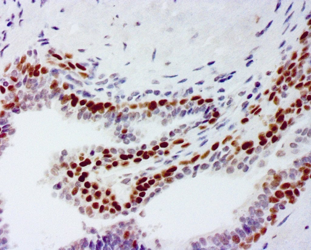 ihcDirect p40 (Clone R392) on frozen prostate