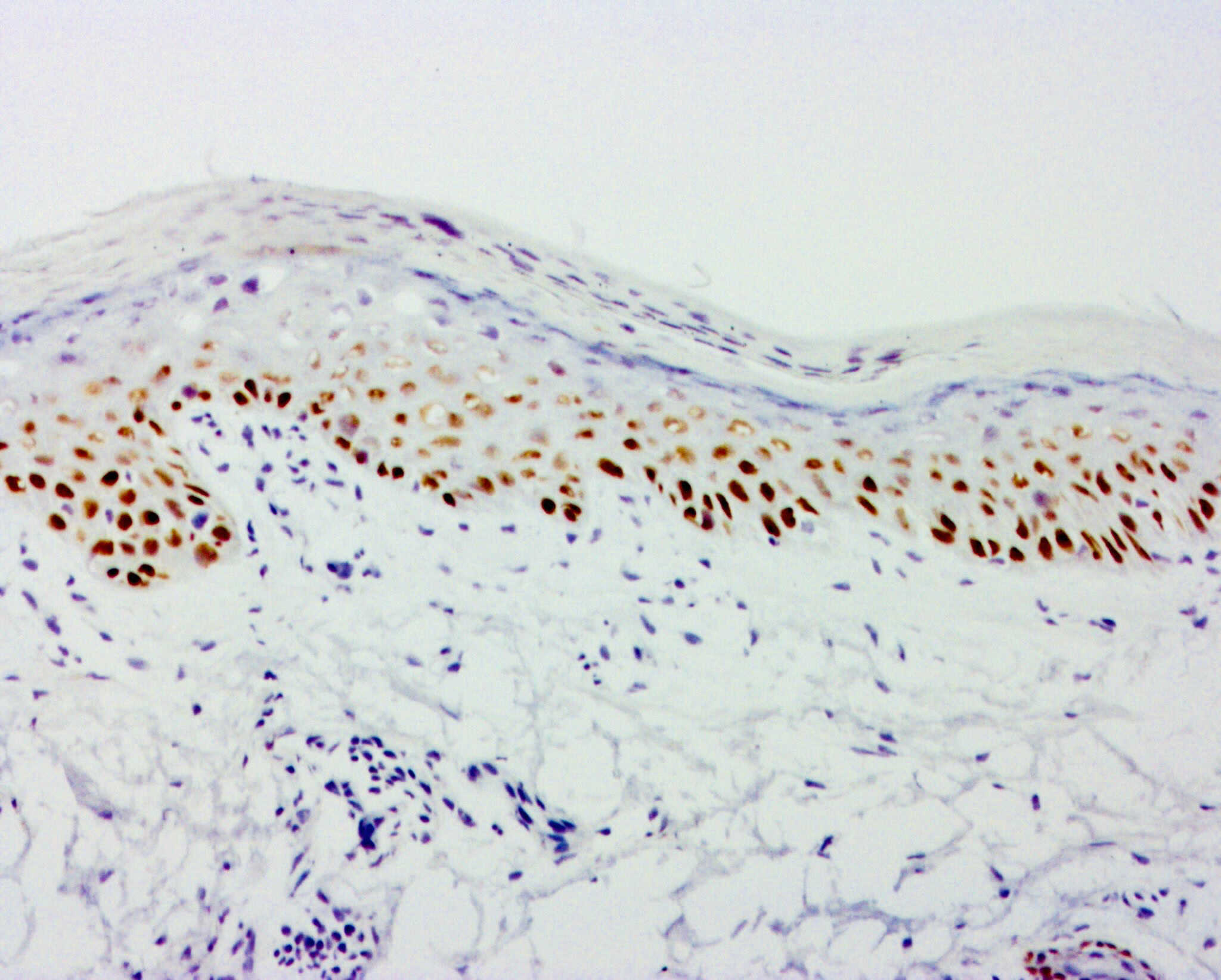 ihcDirect p40 (Clone R392) on frozen skin